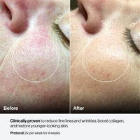 Celluma MYSTIQUE LED Mask (COMING SOON)